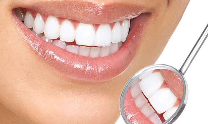 Teeth Whitening - Vancouver Oak Street Dentistry